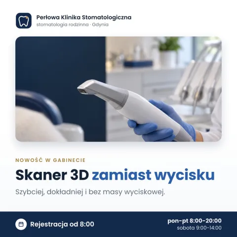 Przykładowa grafika: skaner 3D zamiast masy wyciskowej